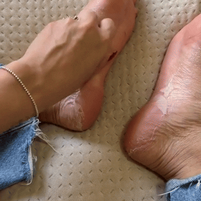 Peeling 21 - VAR Peeling 1 (2).gif__PID:1cad7697-c1df-4646-a0f8-1e6da4f189ef