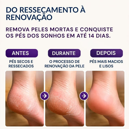 Máscara Peeling Renovadora para os Pés