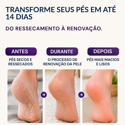 Máscara Peeling Renovadora para os Pés