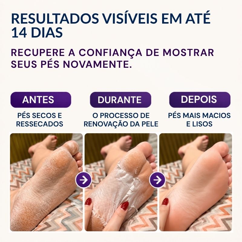 Máscara Peeling Renovadora para os Pés