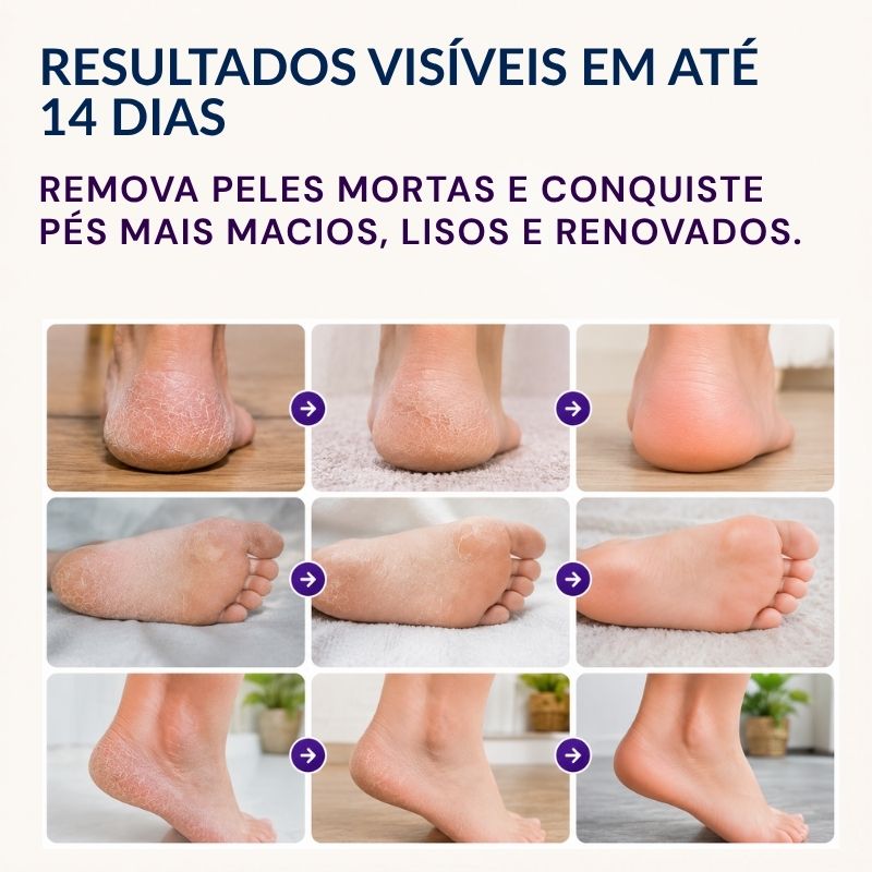Máscara Peeling Renovadora para os Pés