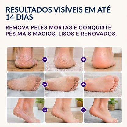 Máscara Peeling Renovadora para os Pés