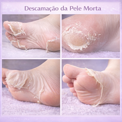 máscara peeling para os pés, meia esfoliante para os pés, peeling para os pés, máscara esfoliante para os pés, remover pele morta dos pés, eliminar calosidades, remover pele ressecada, tratamento para pés ressecados, hidratação dos pés, pés macios, pés lisos, renovar a pele dos pés, remover asperezas, calcanhares rachados, descamação dos pés, esfoliação dos pés, cuidados com os pés, tratamento para calcanhares, máscara para pés, peeling químico para os pés, Pisato Máscara Peeling para os Pés