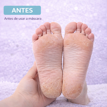 máscara peeling para os pés, meia esfoliante para os pés, peeling para os pés, máscara esfoliante para os pés, remover pele morta dos pés, eliminar calosidades, remover pele ressecada, tratamento para pés ressecados, hidratação dos pés, pés macios, pés lisos, renovar a pele dos pés, remover asperezas, calcanhares rachados, descamação dos pés, esfoliação dos pés, cuidados com os pés, tratamento para calcanhares, máscara para pés, peeling químico para os pés, Pisato Máscara Peeling para os Pés